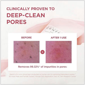 SKIN1004 Madagascar Centella Poremizing Deep Cleansing Foam - www.Kskin.ie  